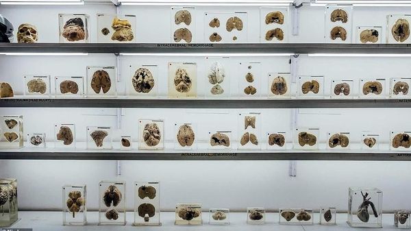 Foto: Museum Otak di India, Kalau Takut Jangan Lihat!