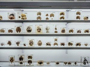 Foto: Museum Otak di India, Kalau Takut Jangan Lihat! Foto: Museum Otak di India, Kalau Takut Jangan Lihat!