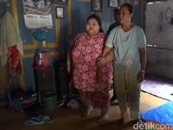 Ini Silvia, Gadis Lamongan yang Putus Sekolah karena Berbobot 197 Kg