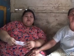 Bukan Cuma Karena Banyak Makan, Ini Kemungkinan Penyebab Obesitas Selvia