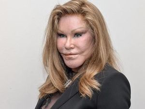 Sosialita Jocelyne Wildenstein Meninggal saat Tidur Siang, Inikah Pemicunya? Sosialita Jocelyne Wildenstein Meninggal saat Tidur Siang, Inikah Pemicunya?