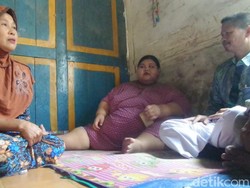 Heboh Gadis Lamongan Berbobot 179 Kg, Aria Bocah Tergemuk Pernah Lebih Gemuk