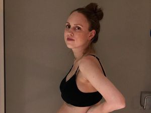 Begini Kondisi Perut Wanita yang Baru Melahirkan 3 Bayi Kembar