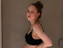 Begini Kondisi Perut Wanita yang Baru Melahirkan 3 Bayi Kembar