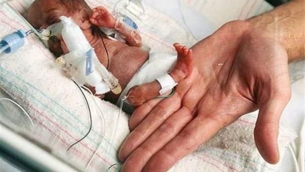 Potret Mengejutkan Mereka yang Menjadi Terkecil di Dunia