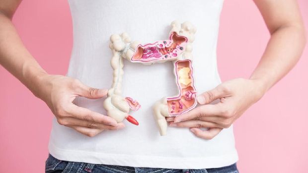4 Fakta Kanker Usus Seperti Diidap Titi Qadarsih, Bunda Perlu Tahu