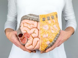 Fakta-fakta Kanker Organ Pencernaan Meningkat di Usia Muda, Waspadai Gejalanya