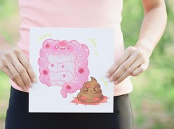 Jadi Penyebab Istri Ustad Maulana Meninggal, Ini 4 Fakta Kanker Usus