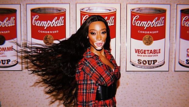 Winnie Harlow Winnie Harlow