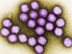 6 Anak Tewas Akibat Wabah Virus di Amerika Serikat