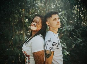 Tunangan dengan Wanita Idap Penyakit Langka, Kisah Cinta Pria Ini Viral