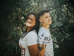 Tunangan dengan Wanita Idap Penyakit Langka, Kisah Cinta Pria Ini Viral