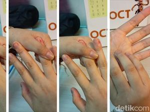 Pusing karena Kelelahan? 5 Teknik Pijat Praktis Ini Bisa Meredakannya Pusing karena Kelelahan? 5 Teknik Pijat Praktis Ini Bisa Meredakannya