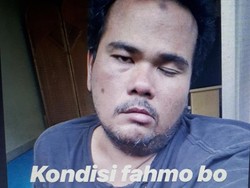 Sempat Terkena Stroke, Bagaimana Kondisi Fahmi Bo?