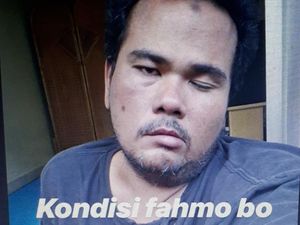 Sempat Terkena Stroke, Bagaimana Kondisi Fahmi Bo? Sempat Terkena Stroke, Bagaimana Kondisi Fahmi Bo?