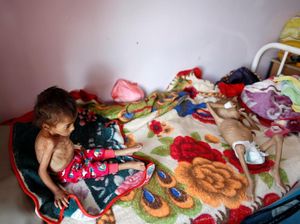 Memilukan! Perang Bikin 85 Ribu Anak-anak Mati Kelaparan di Yaman