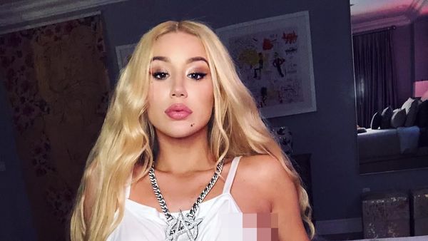 Foto: Wajah Baru Iggy Azalea yang Dikabarkan Oplas Rp 150 Juta