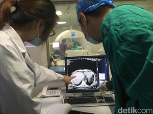 Cryosurgery untuk Kanker Banyak Diminati, Seperti Ini Cara Kerjanya Cryosurgery untuk Kanker Banyak Diminati, Seperti Ini Cara Kerjanya