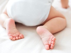 Cara Mengatasi Ruam Popok Pada Bayi dan Penyebabnya