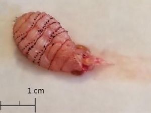 Bulan Madu Jadi Cerita Horor Gara-gara Larva Parasit