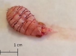 Bulan Madu Jadi Cerita Horor Gara-gara Larva Parasit