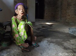 Pilu Rubiah, Nenek Pengidap Kusta di Ponorogo yang Tinggal Sendiri