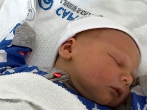 Banyak Bayi di Prancis Lahir Tanpa Tangan, Belum Diketahui Penyebabnya