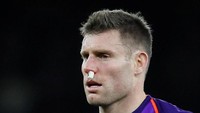 James Milner harus mendapat perawatan tak lama setelah bikin gol karena berbenturan dengan rekan setimnya, Dia mengalami pendarahan di hidung. (David Klein/REUTERS)