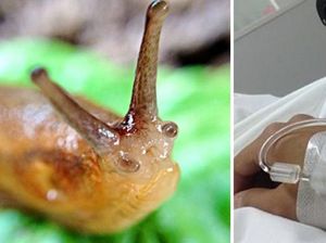 Dipaksa Makan Siput, Remaja Ini Lumpuh dan Meninggal 8 Tahun Kemudian