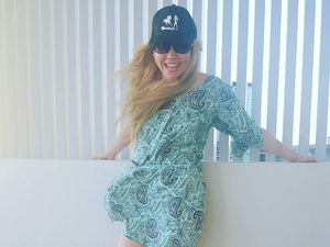 Cerita Inspiratif Wanita yang Kakinya Diamputasi dan Sukses Jadi Model