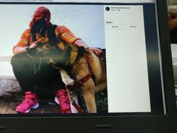 Nekat Suntik Mr P dengan Silikon, Seorang Pria Australia Tewas