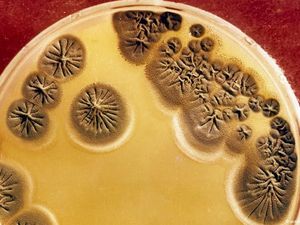 Bakteri Super Bisa Bunuh Jutaan Manusia pada 2050