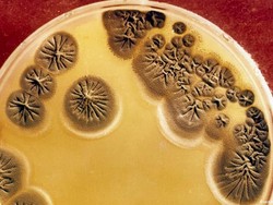 Bakteri Super Bisa Bunuh Jutaan Manusia pada 2050