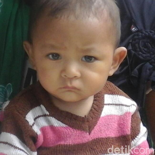 Berita Tolong! Bayi Korban Gempa di Lombok Barat Kena Tumor Mata Ganas Sabtu 4 Mei 2024