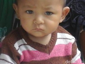 Tolong! Bayi Korban Gempa di Lombok Barat Kena Tumor Mata Ganas