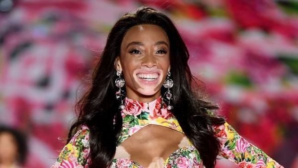 Model yang Sempat Dihina Mirip Zebra, Tampil Memukau di Victorias Secret