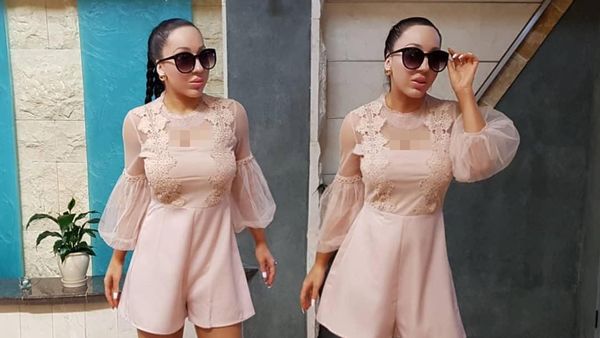 Potret Wanita Kembar Oplas Rp 2,8 Miliar dan Berbagi Calon Suami yang Sama