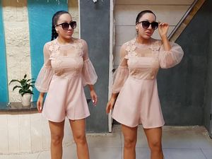 Potret Wanita Kembar Oplas Rp 2,8 Miliar dan Berbagi Calon Suami yang Sama