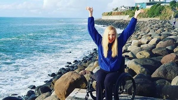 Inspiratif, Kisah Model Cantik yang Kehilangan Satu Kaki dan Jari Tangan