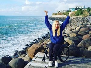 Inspiratif, Kisah Model Cantik yang Kehilangan Satu Kaki dan Jari Tangan