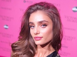 Seperti Inilah Wajah Asli Bidadari Victorias Secret, Ternyata Jerawatan