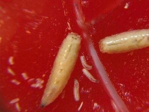 Pria Ini Selamat dari Infeksi Setelah Diterapi dengan 400 Belatung Pria Ini Selamat dari Infeksi Setelah Diterapi dengan 400 Belatung