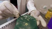Mengintip Belatung Medis, Terapi Luka yang Bisa Kembali Populer