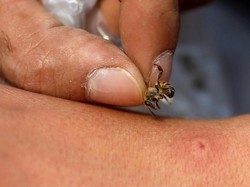 Wanita Tewas Disengat Lebah Saat Bersihkan Kebun di Sulbar