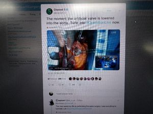 Ngilu Atau Takjub? Operasi Jantung Ditayangkan Langsung di Televisi Inggris