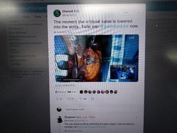 Ngilu Atau Takjub? Operasi Jantung Ditayangkan Langsung di Televisi Inggris