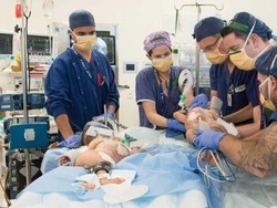 Kembar Siam yang Dipisahkan di Melbourne Masih Saling Bersilang Kaki Ketika Tidur