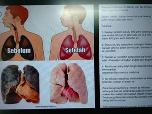 Viral! Ramuan Pembersih Paru-paru bagi Perokok, Benar Bisa Nggak Sih? Viral! Ramuan Pembersih Paru-paru bagi Perokok, Benar Bisa Nggak Sih?