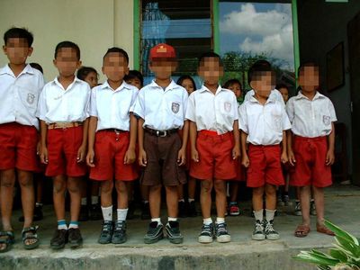 Begini Perbandingan Tubuh Anak Sehat Vs Anak Stunting