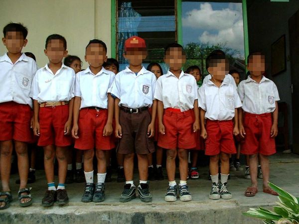 Begini Perbandingan Tubuh Anak Sehat Vs Anak Stunting